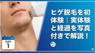 ヒゲ脱毛を初体験|実体験と経過を写真付きで解説!