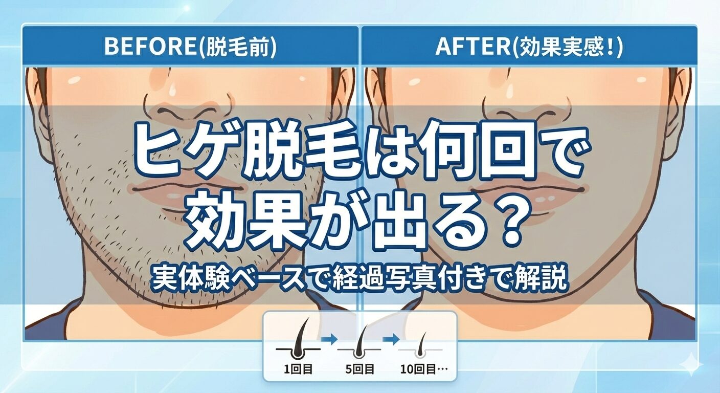 ヒゲ脱毛は何回で効果が出る？実体験ベースで経過写真付きで解説