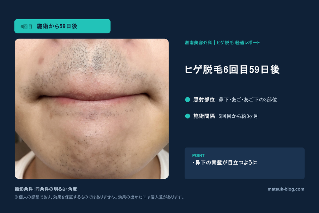 ヒゲ脱毛6回目から59日後の様子