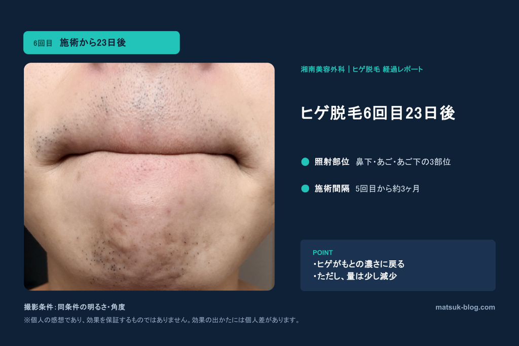 施術20日後のアゴ周り。新しい毛が生え始める