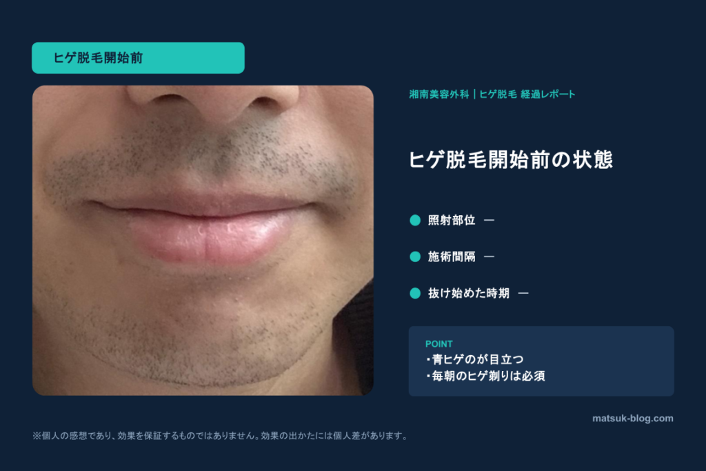 ヒゲ脱毛を始める前の状態