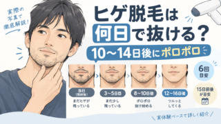 ヒゲ脱毛は何日で抜ける?照射10〜14日後にポロポロ落ちた経過を写真で全公開