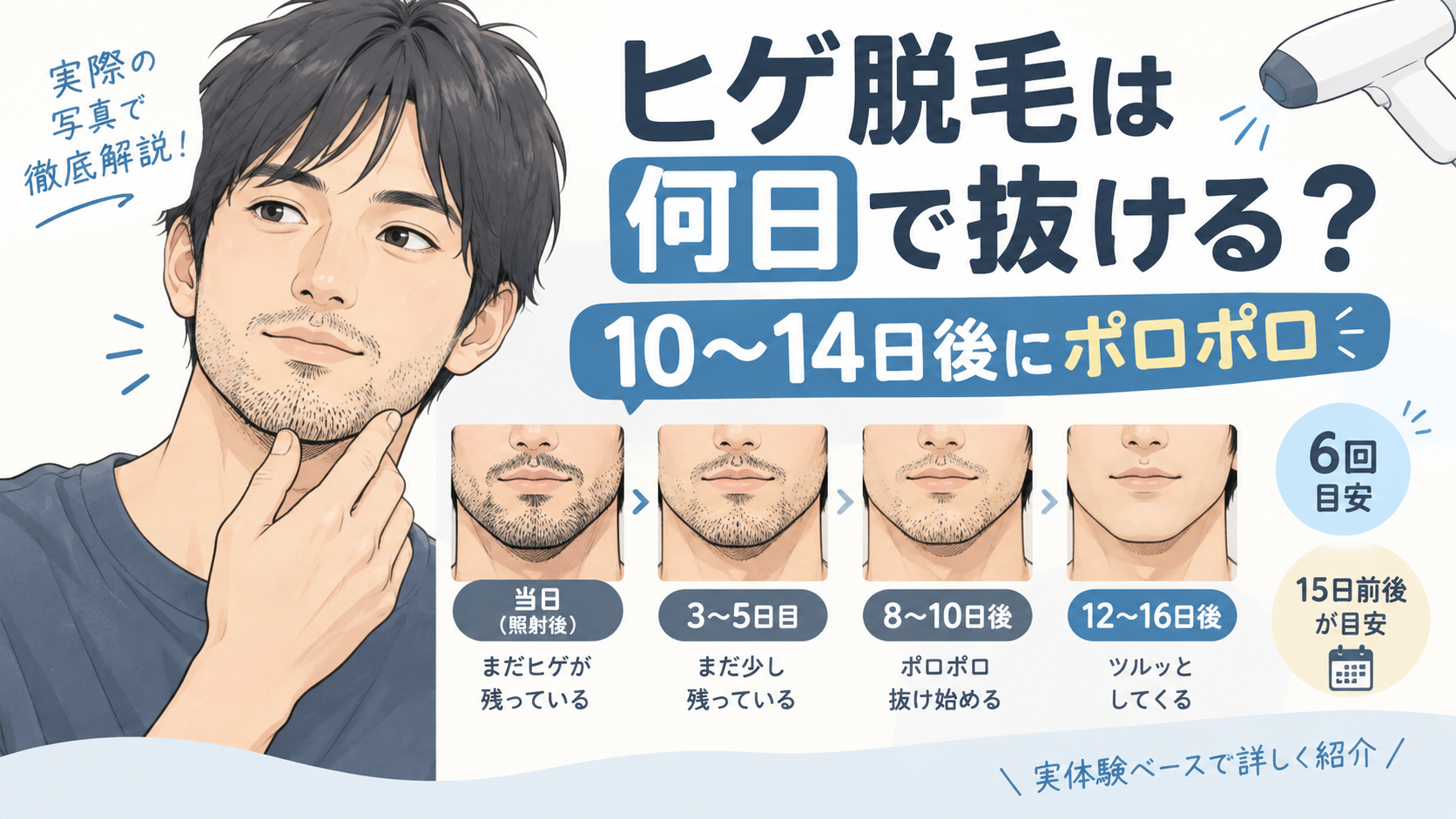 ヒゲ脱毛は何日で抜ける？照射10〜14日後にポロポロ落ちた経過を写真で全公開
